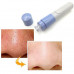 Вакуумный очиститель пор Pore Cleaner Вакуумный очиститель пор Pore Cleaner